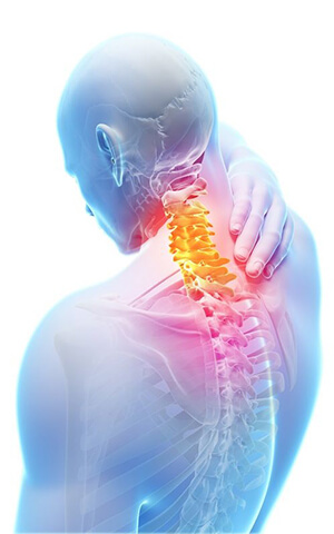 Dolor cervical, ¿qué es? Síntomas y tratamiento